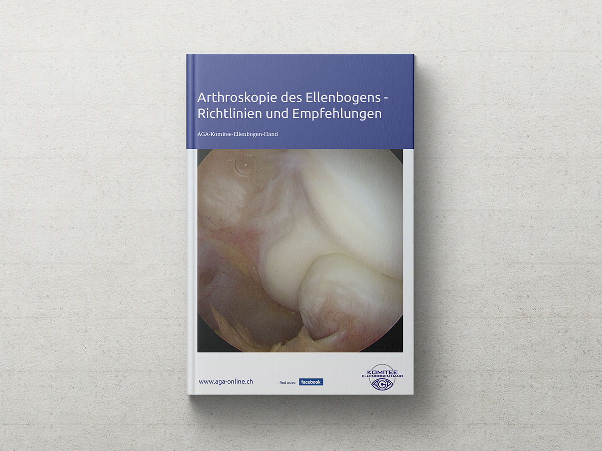Arthroskopie des Ellenbogens - Richtlinien und Empfehlungen | Prof. Dr. Andreas Lenich