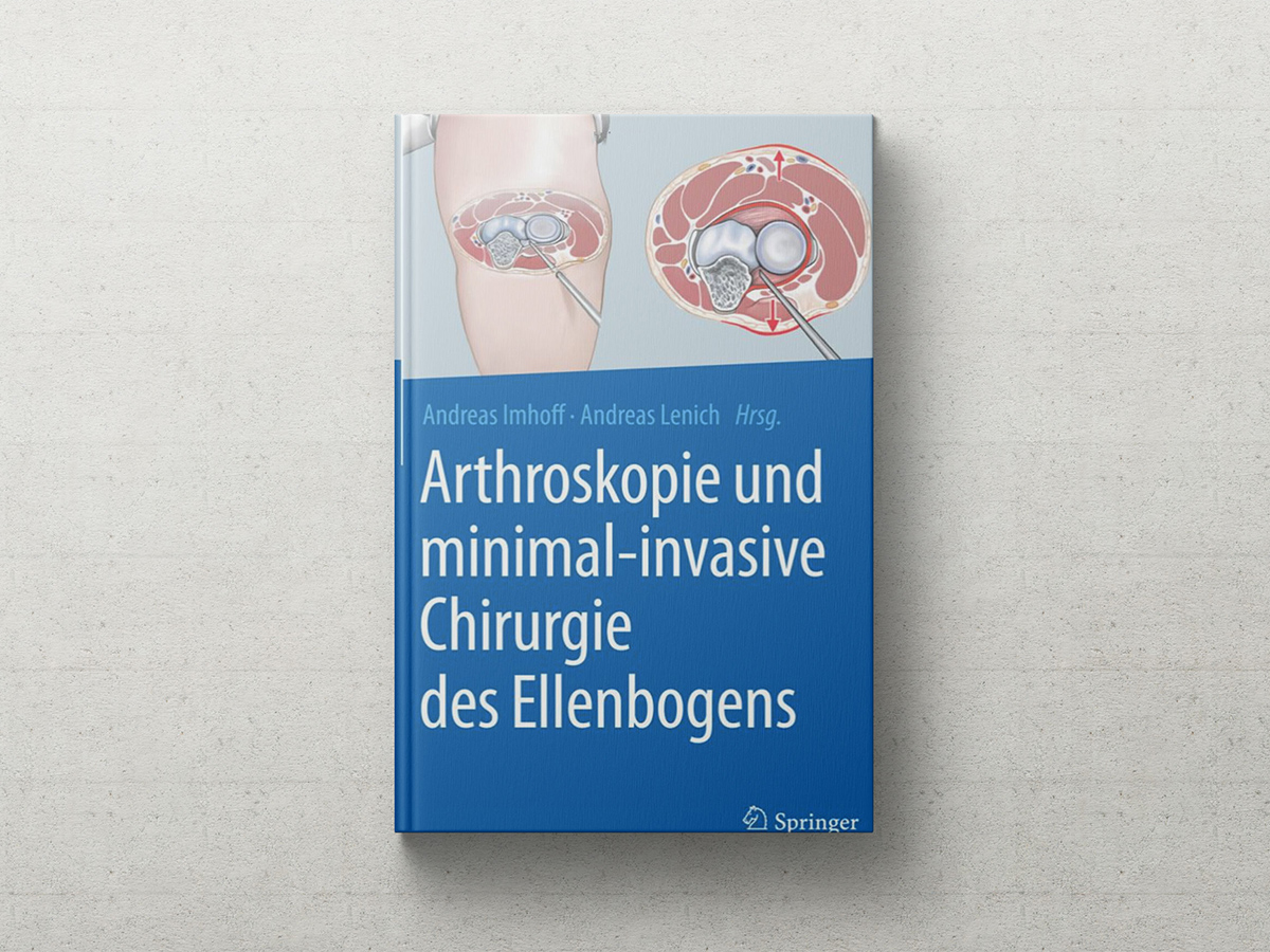 Arthroskopie und minimal-invasive Chirurgie des Ellenbogens | Prof. Dr. Andreas Lenich